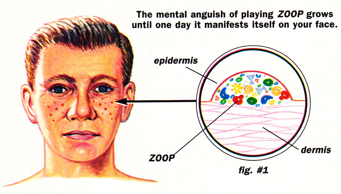 diagram of a guy with pimples. The mental anguish of playing Zoop grows until one day it manifests itself on your face